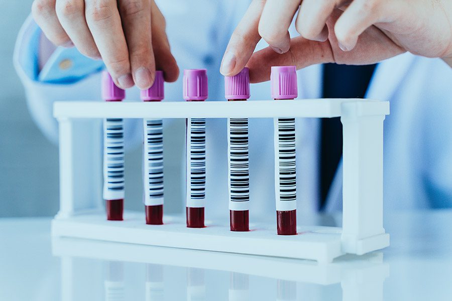 Hands of a lab technician with blood test sample tubes in a row for laboratory blood analysis 800px
